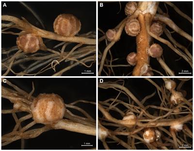 Differential symbiotic compatibilities between rhizobium strains and cultivated and wild soybeans revealed by anatomical and transcriptome analyses